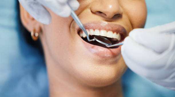 Best Broken or Cracked Tooth Emergency Dentist in Pine Valley, CA